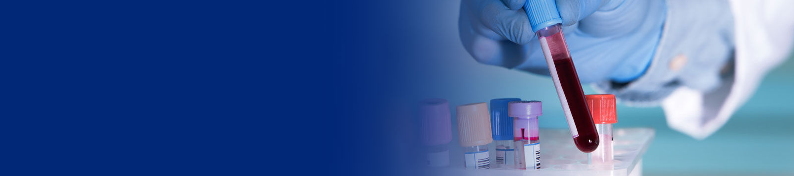 Schnellere Blutproben-Nachverfolgung RFID-Fallstudie 06